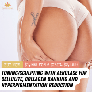 Glute Glow Toning/Sculpting With Aerolase