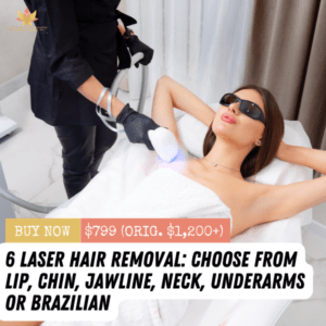 6 Laser Hair Removal Treatments