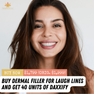 Filler for Laugh Lines + 40 Units of Daxxify