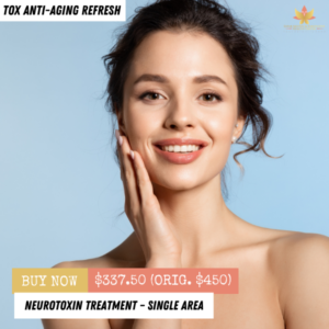 Neurotoxin Treatment — Single Area