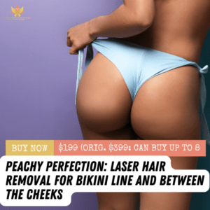 Peachy Perfection: Laser Hair Removal