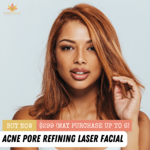 Acne Pore Refining Laser Facial