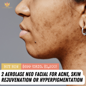 2 Aerolase Neo Facials