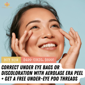 Aerolase Era Peel + Under-Eye PDO Threads