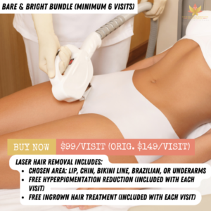 laser hair removal