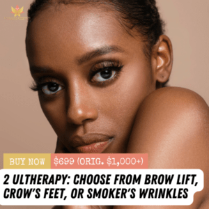 2 Ultherapy Treatments