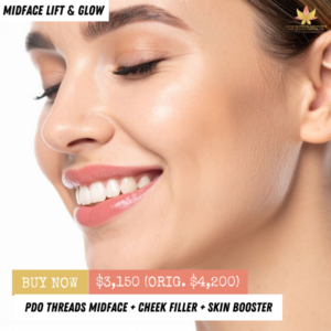 PDO Threads Midface + Cheek Filler + Skin Booster