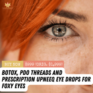 Botox, PDO Threads + Upneeq Eye Drops