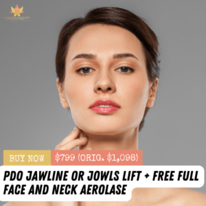 PDO Jaw Lift + Free Aerolase