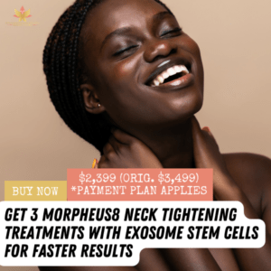 Morpheus8 for Neck With Exosome Stem Cells