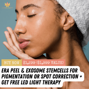 Era Peel and Exosome Stemcells + Free LED Light Therapy