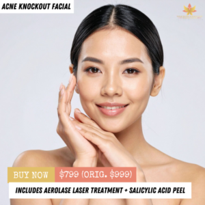 Acne Knockout Facial