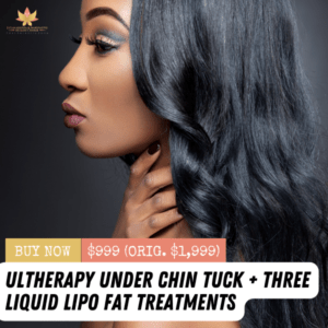 Ultherapy Under Chin + 3 Liquid Lipo Treatments