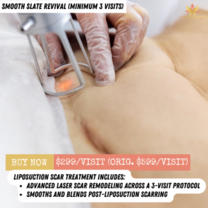 LIPOSUCTION SCAR TREATMENT