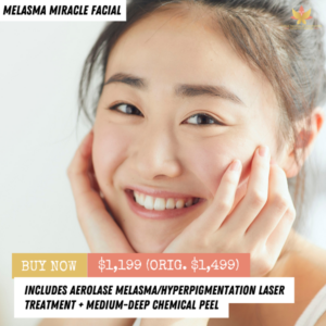 Melasma Miracle Facial