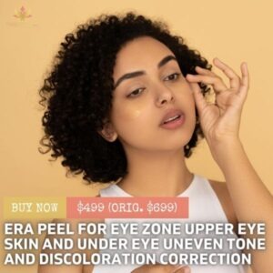 Era Peel for Upper Eye Zone