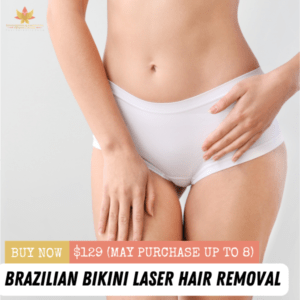 Brazilian Bikini Laser Hair Removal