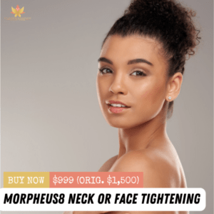 Morpheus8 for Face or Neck