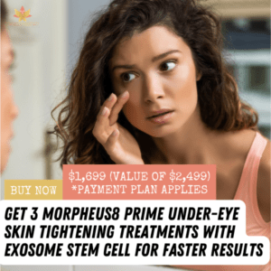 Morpheus8 Prime Under-Eye Treatment With Exosome Stem Cells