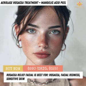 Rosacea Relief Facial — Save 20%