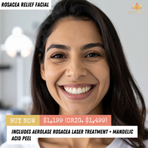 Rosacea Relief Facial