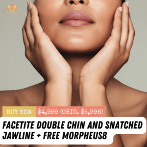 FaceTite Double Chin + Morpheus8