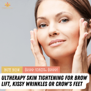 Ultherapy Skin Tightening for Face