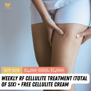 Weekly RF Cellulite Treatment