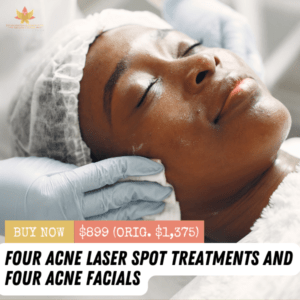 Acne Laser Spot Treatments + Acne Facials