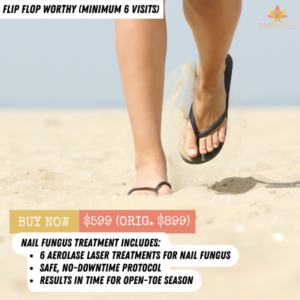NAIL FUNGUS TREATMENT