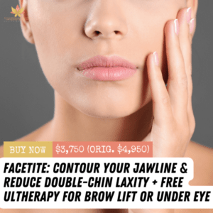 FaceTite + Free Ultherapy