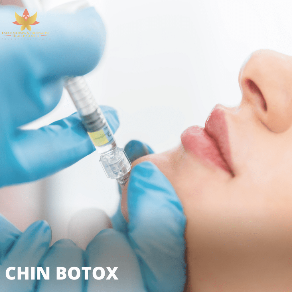 Sculptra Injections - Estar MedSpa & Innovative Health Center