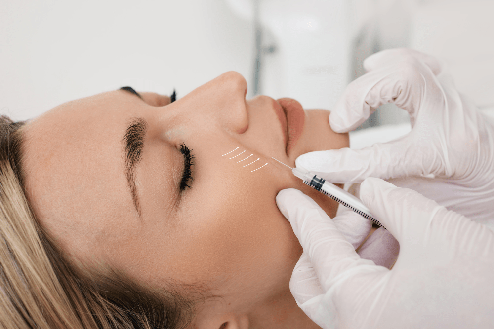 RHA Dermal Fillers in Olney