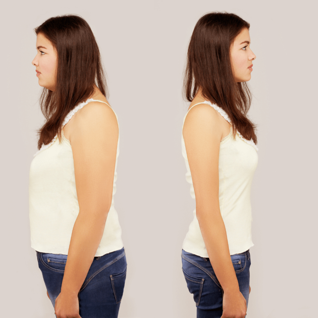 Weight Loss Injections in Olney Maryland