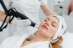 woman getting an Aerolase laser facial in Olney MD
