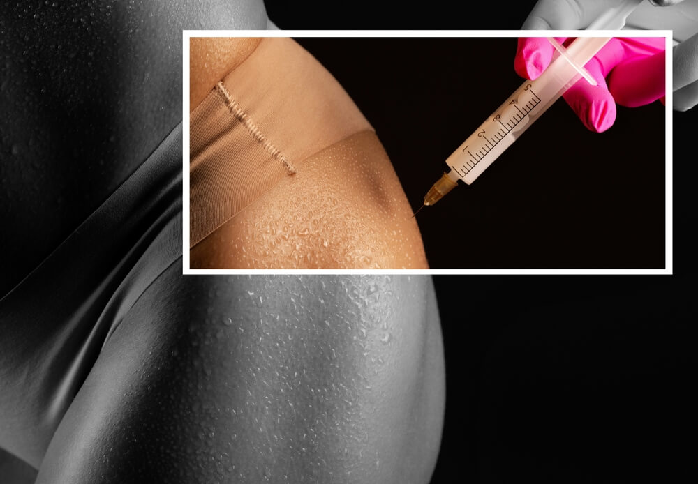 AlloClae hip dip treatment Montgomery County