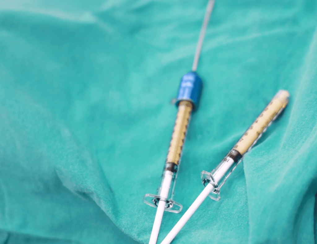 Alloclae Olney Maryland