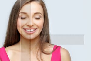 measuring patient for facial asymmetry