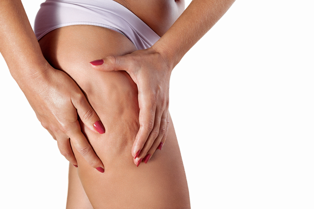 cellulite more common in women