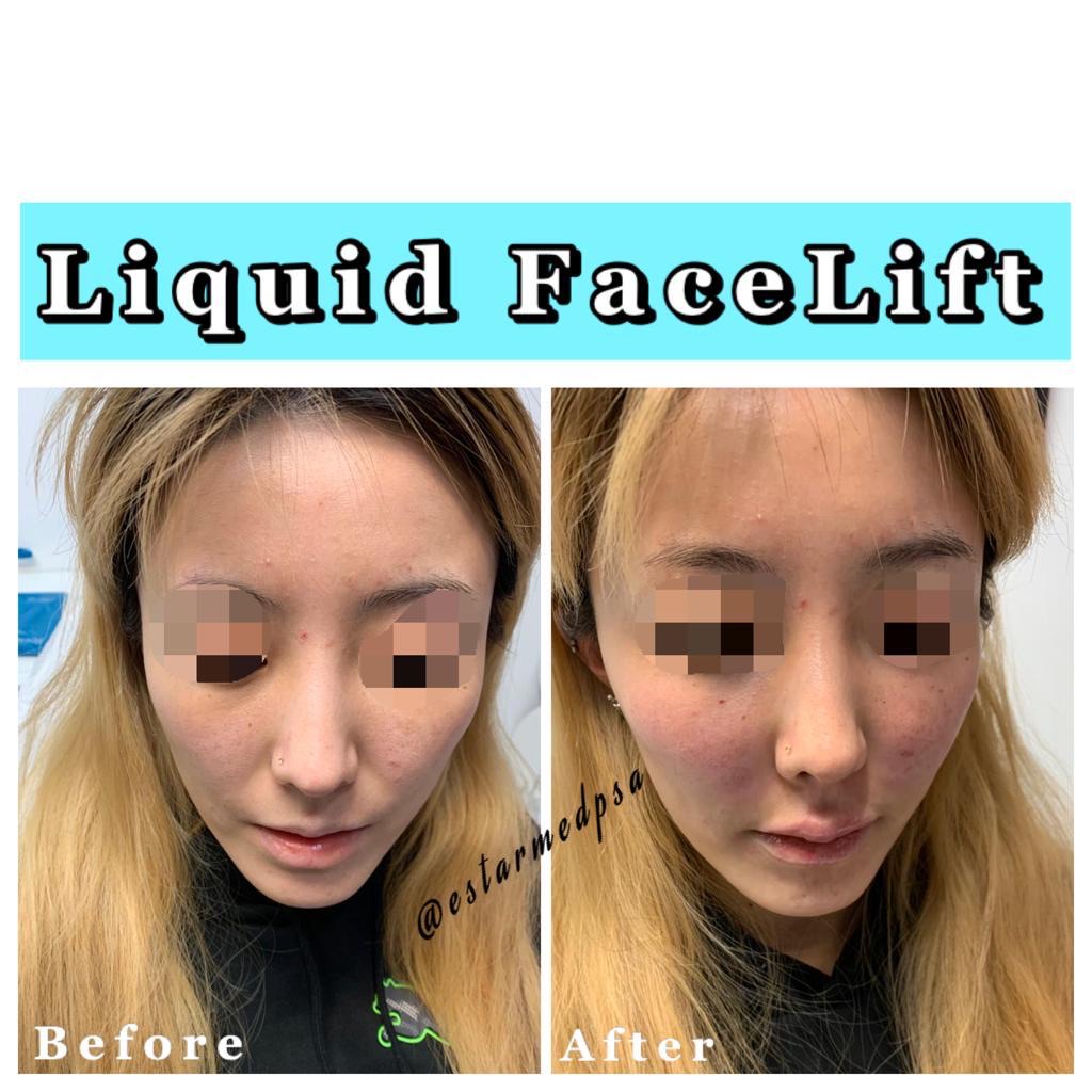 f2c3b984-1cf9-4be5-a1a2-a656231c9e4a