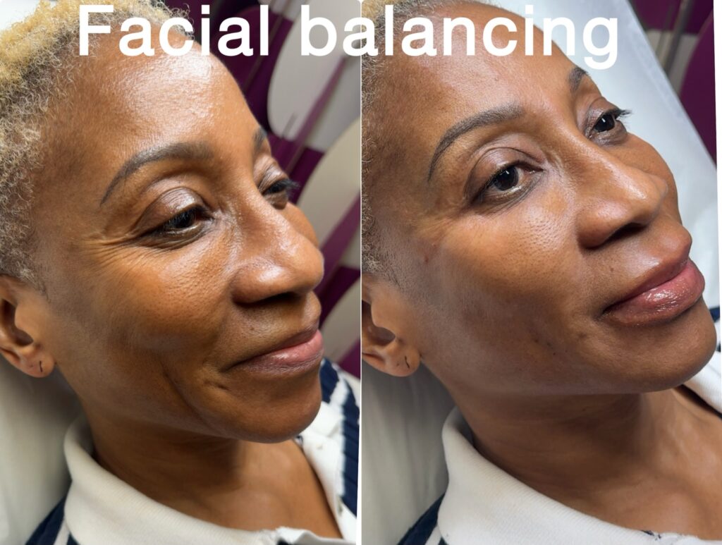 facial-balancing-10