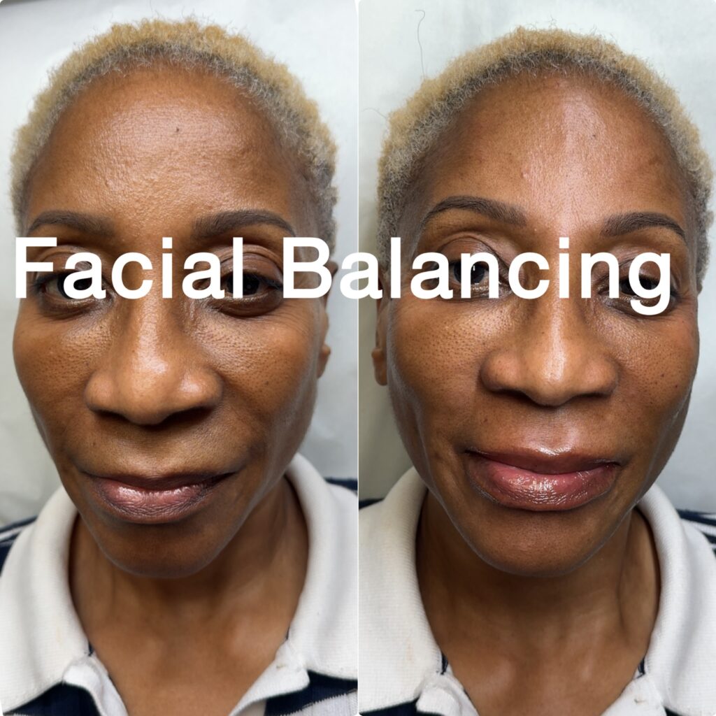 facial-balancing-11