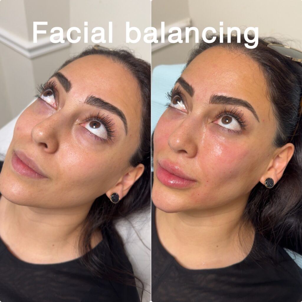 facial-balancing-12