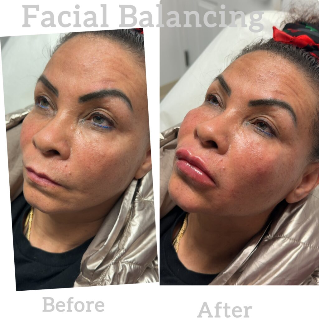 facial-balancing-14