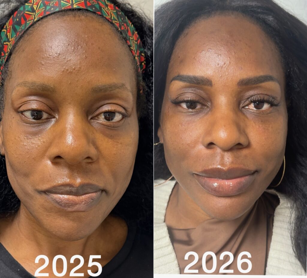 facial-balancing-15
