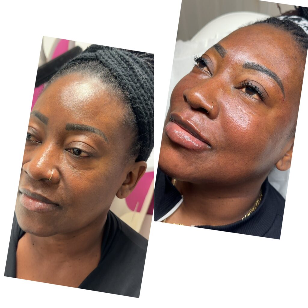 facial-balancing-18