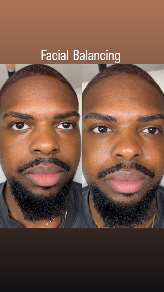 facial-balancing-2