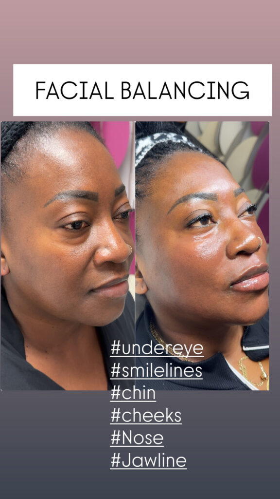 facial-balancing-4