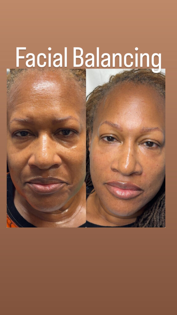 facial-balancing