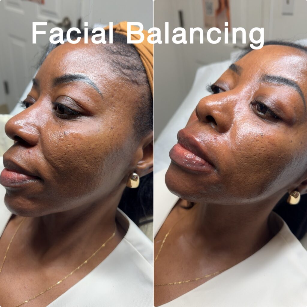 facial-balancing-7